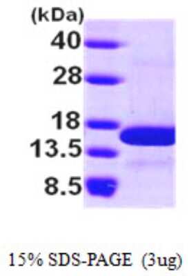 SDS-PAGE: Recombinant Human NHP2L1 His Protein [NBP1-50896]