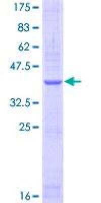 SDS-PAGE: Recombinant Human NPRA/NPR1 GST (N-Term) Protein [H00004881-Q01]