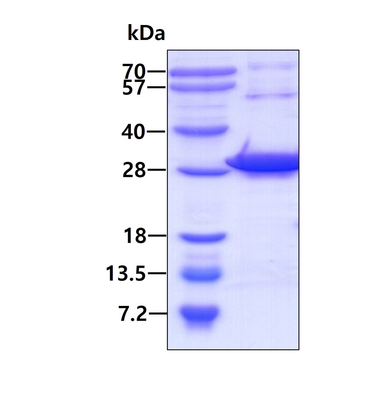 SDS-PAGE: Recombinant Human NXT2 His Protein [NBP1-99079]
