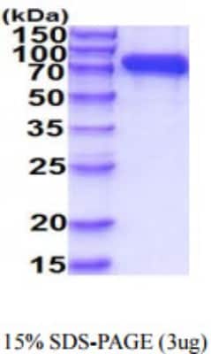 SDS-PAGE: Recombinant Human Neprilysin/CD10 His Protein [NBP2-59882]