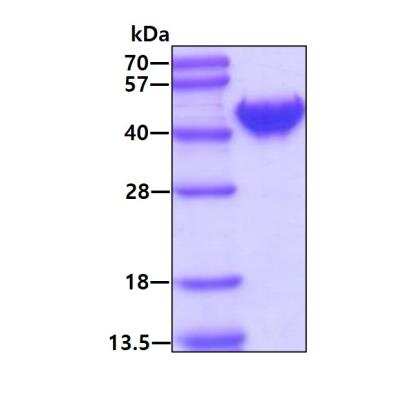 SDS-PAGE: Recombinant Human OAS1 His Protein [NBP1-30214]