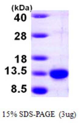 SDS-PAGE: Recombinant Human PCBD1 His Protein [NBP1-48354]