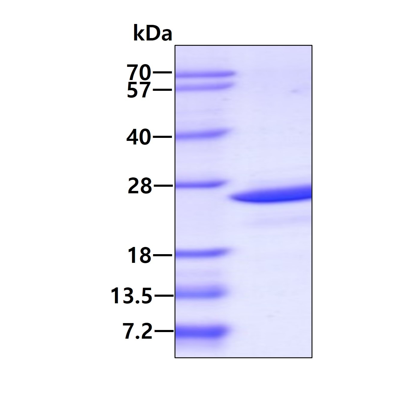 SDS-PAGE: Recombinant Human PDCD6 His Protein [NBP1-51048]