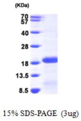 SDS-PAGE: Recombinant Human PDRG1 His Protein [NBP1-50871]
