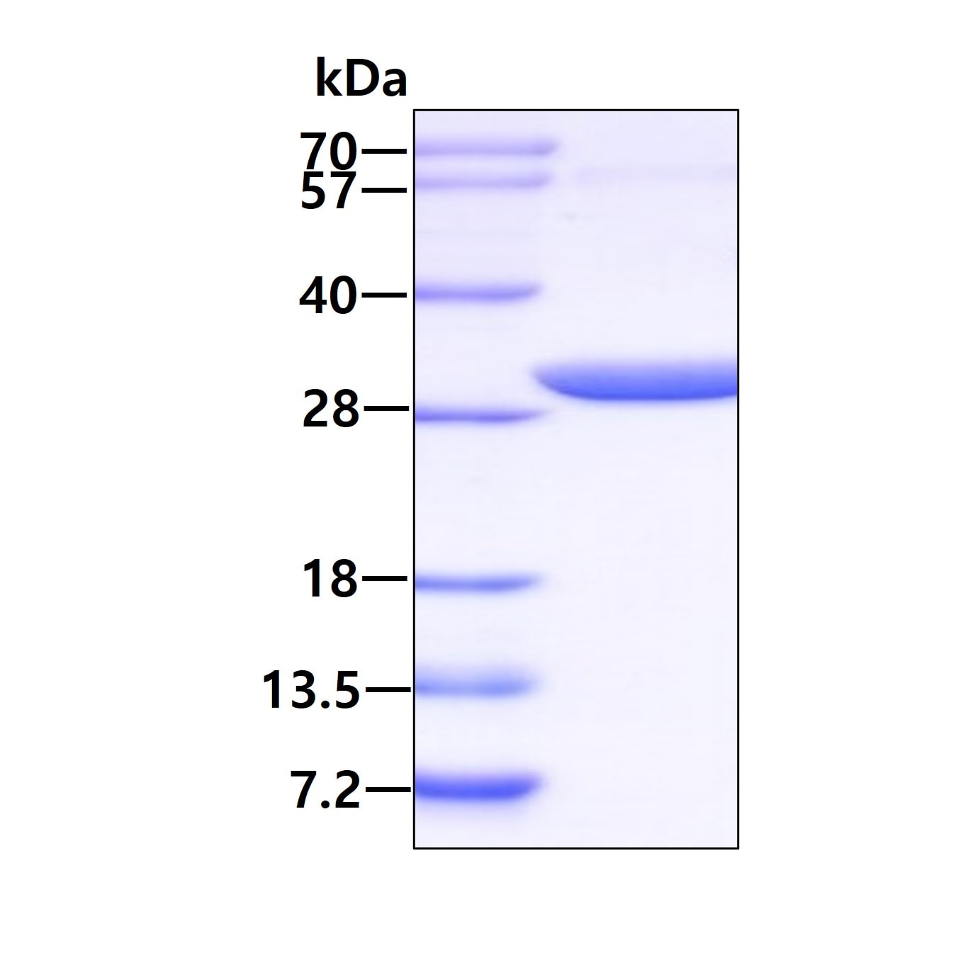 SDS-PAGE: Recombinant Human PGLS His Protein [NBP1-49446]