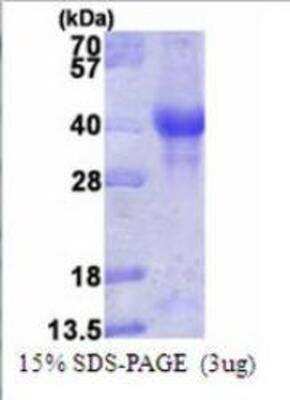 SDS-PAGE: Recombinant Human PINK1 Protein [NBP1-72481]