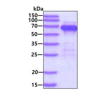 SDS-PAGE: Recombinant Human PPIL2 His Protein [NBP1-41225]