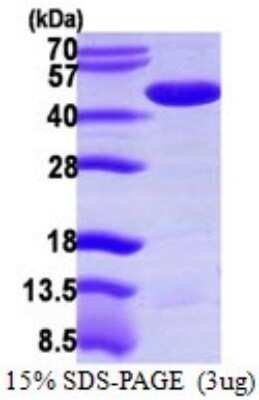 SDS-PAGE: Recombinant Human PPME1 His Protein [NBP1-72395]