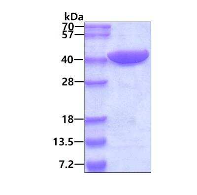 SDS-PAGE: Recombinant Human PRPS2 His Protein [NBP2-52113]
