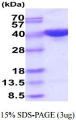 SDS-PAGE: Recombinant Human PSG5 His Protein [NBP2-59885]