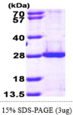 SDS-PAGE: Recombinant Human PSMB5 His Protein [NBP1-50934]