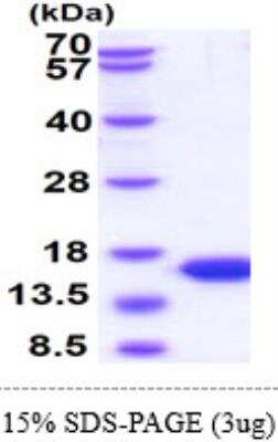 SDS-PAGE: Recombinant Human Parvalbumin His Protein [NBP1-50865]