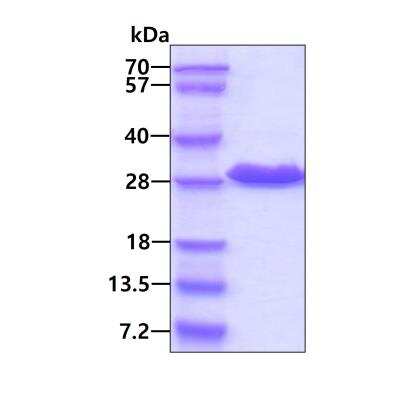 SDS-PAGE: Recombinant Human Phosphoserine phosphatase Protein [NBC1-18384]