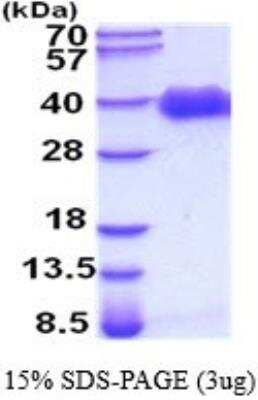 SDS-PAGE: Recombinant Human Pref-1/DLK1/FA1 His Protein [NBP2-52245]