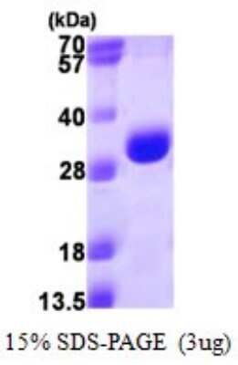 SDS-PAGE: Recombinant Human Proteasome 20S alpha 3 His Protein [NBP1-72526]
