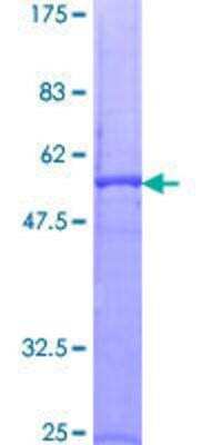 SDS-PAGE: Recombinant Human Proteinase 3/Myeloblastin/PRTN3 GST (N-Term) Protein [H00005657-P01]