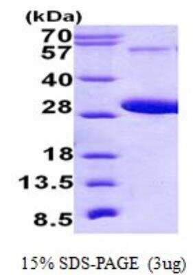 SDS-PAGE: Recombinant Human RAB5C His Protein [NBP2-23393]