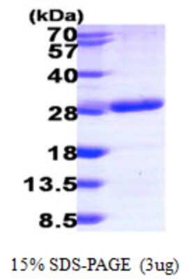 SDS-PAGE: Recombinant Human RAB6B His Protein [NBP1-50995]