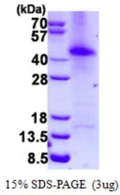 SDS-PAGE: Recombinant Human RAP30 His Protein [NBP3-17983]