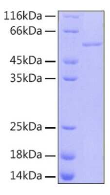 SDS-PAGE: Recombinant Human RBBP4/RbAp48 Protein [NBP3-18203]