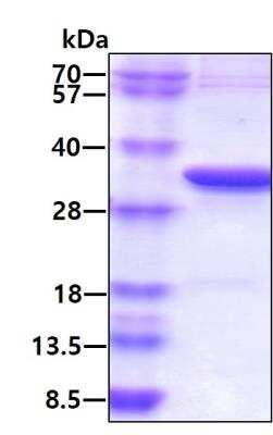 SDS-PAGE: Recombinant Human RPA2 His Protein [NBP1-50878]