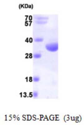 SDS-PAGE: Recombinant Human RQCD1 His Protein [NBP1-50873]
