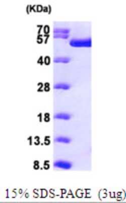 SDS-PAGE: Recombinant Human RUVBL1 His Protein [NBP1-50845]