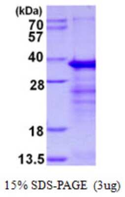 SDS-PAGE: Recombinant Human RYBP/DEDAF His Protein [NBP1-98929]