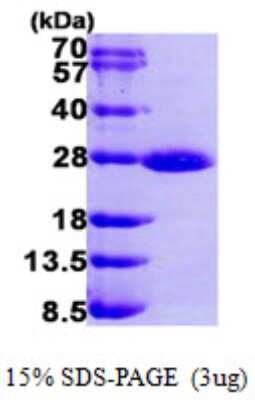 SDS-PAGE: Recombinant Human Rab1A His Protein [NBP1-50980]
