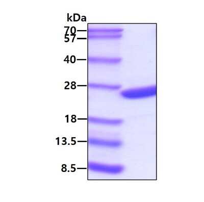 SDS-PAGE: Recombinant Human Recoverin Protein [NBC1-18499]