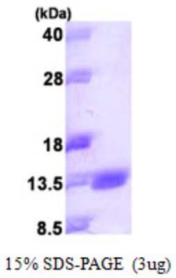 SDS-PAGE: Recombinant Human S100 calcium binding protein A14 His Protein [NBP1-51039]