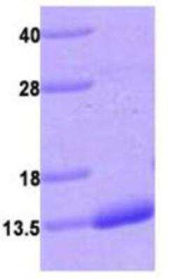 SDS-PAGE: Recombinant Human S100A4 His Protein [NBC1-27983]
