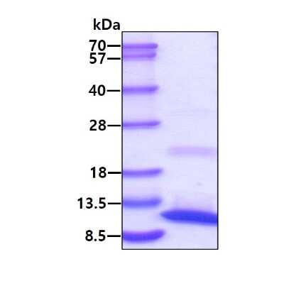 SDS-PAGE: Recombinant Human S100A8 Protein [NBP1-44482]