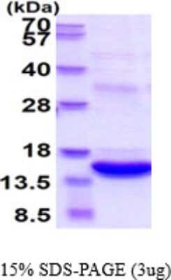 SDS-PAGE: Recombinant Human S100A8 His-Myc Protein [NBP2-50570]