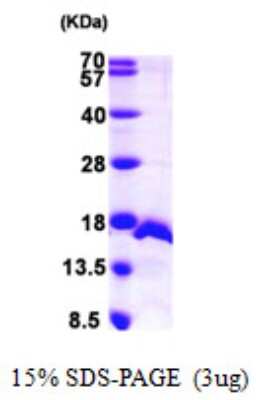 SDS-PAGE: Recombinant Human SF3B14 His Protein [NBP1-50997]