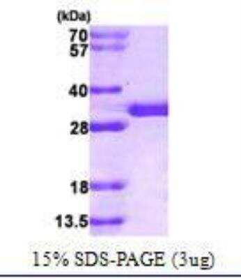 SDS-PAGE: Recombinant Human SPR His Protein [NBC1-21657]