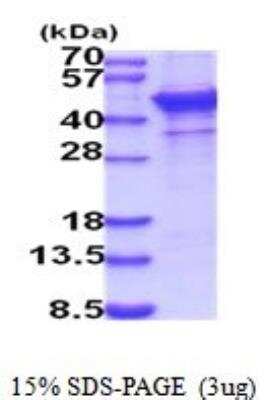 SDS-PAGE: Recombinant Human ST6 Gal Sialyltransferase 1/ST6GAL1/CD75 His Protein [NBP2-52038]