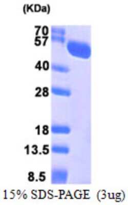 SDS-PAGE: Recombinant Human STCH His Protein [NBP1-51041]
