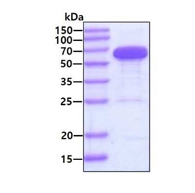 SDS-PAGE: Recombinant Human STI1 His Protein [NBP1-30289]