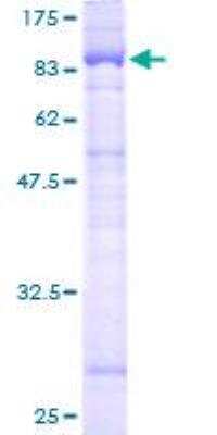SDS-PAGE: Recombinant Human SUR-8 GST (N-Term) Protein [H00008036-P01]