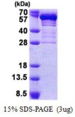 SDS-PAGE: Recombinant Human Secretogranin 3 His Protein [NBP2-23456]