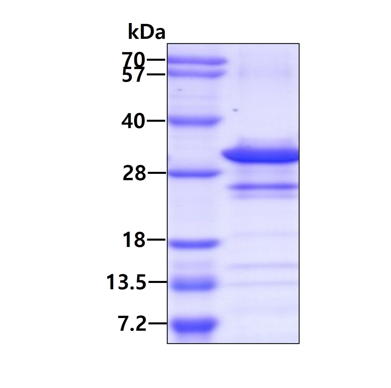 SDS-PAGE: Recombinant Human Secretogranin V His Protein [NBP1-48343]