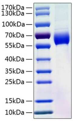 SDS-PAGE: Recombinant Human Serpin A8/Angiotensinogen His (C-Term) Protein [NBP3-18196]