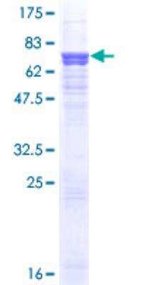 SDS-PAGE: Recombinant Human Serpin A8/Angiotensinogen GST (N-Term) Protein [H00000183-P01]