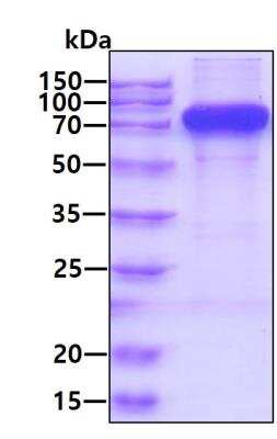 SDS-PAGE: Recombinant Human Siglec-9 hIgG-His Protein [NBP2-59906]
