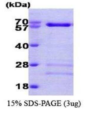 SDS-PAGE: Recombinant Human Smad4 His Protein [NBC1-22616]