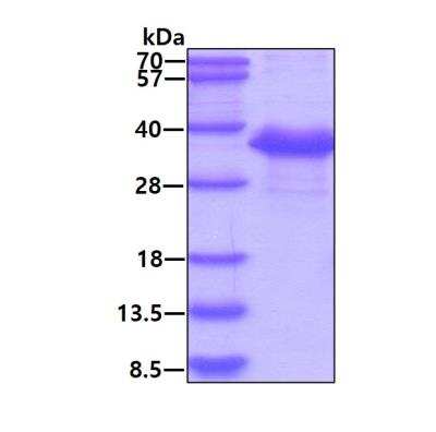 SDS-PAGE: Recombinant Human Survivin Calmodulin Protein [NBC1-18508]