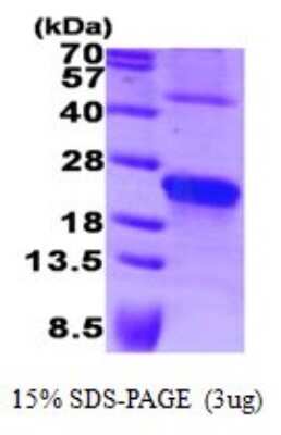 SDS-PAGE: Recombinant Human Syndecan-4 Protein [NBP1-72277]