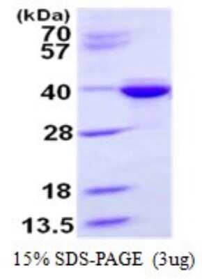 SDS-PAGE: Recombinant Human Syntaxin 3 His Protein [NBP1-99023]