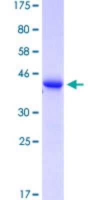 SDS-PAGE: Recombinant Human TCR V delta GST (N-Term) Protein [H00006964-Q01]